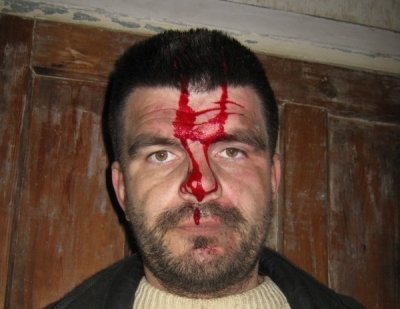 Александр Кузнецов заявил об избиении из-за общественной деятельности. Фото: 24ukrnews.com