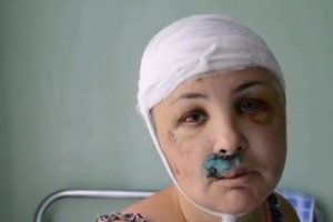 Изнасилованная милиционерами женщина. Фото: Novosti-n